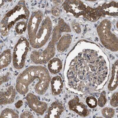 Immunohistochemistry-Paraffin: Frizzled-6 Antibody [NBP1-89702] - Staining of human kidney shows moderate to strong cytoplasmic positivity in cells in tubules.