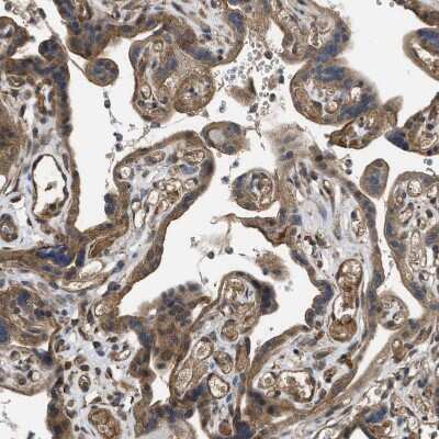 Immunohistochemistry-Paraffin: Frizzled-6 Antibody [NBP1-89702] - Staining of human placenta shows moderate cytoplasmic and membranous positivity in trophoblastic cells.