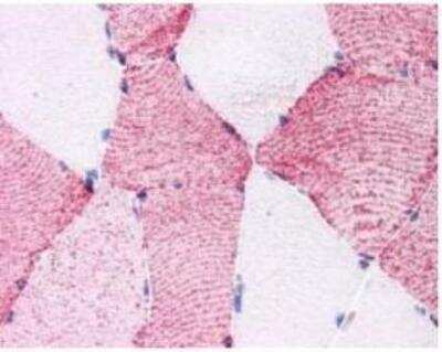 Immunohistochemistry-Paraffin: Frizzled-6 Antibody [NLS4481] - Analysis of anti-Frizzled 6 / FZD6 antibody with human skeletal muscle.