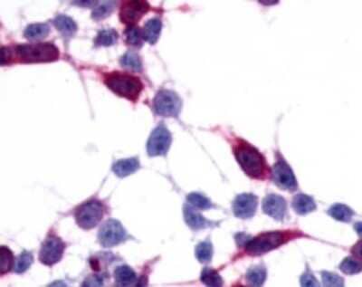 Immunohistochemistry-Paraffin: Frizzled-6 Antibody [NLS4482] - Analysis of anti-Frizzled-6 antibody with transfected cells expressing Frizzled-6 at 6 ug/ ml.