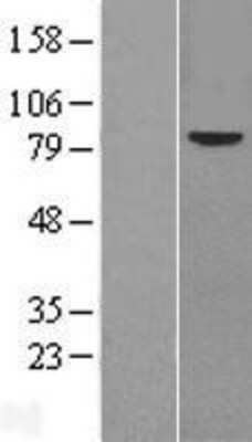 Western Blot Frizzled-6 Overexpression Lysate