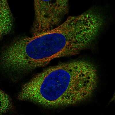 Immunocytochemistry/Immunofluorescence: Frizzled-8 Antibody [NBP2-56913] - Staining of human cell line U-2 OS shows localization to endoplasmic reticulum.