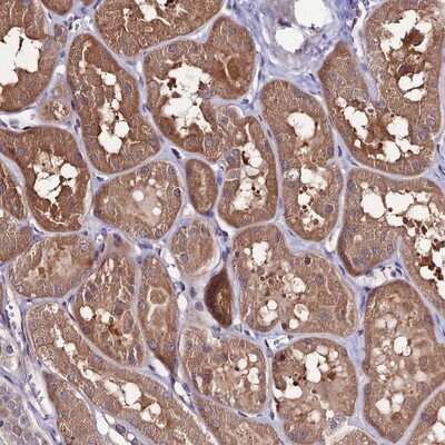 <b>Orthogonal Strategies Validation. </b>Immunohistochemistry-Paraffin: Frizzled-8 Antibody [NBP1-87410] - Staining of human kidney shows moderate cytoplasmic positivity in tubule cells.