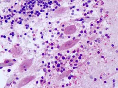 Immunohistochemistry-Paraffin: Frizzled-8 Antibody [NLS4767] - Analysis of anti-FZD8 / Frizzled 8 antibody with human brain, cerebellum, Purkinje neurons at dilution 8-20 ug/ml.