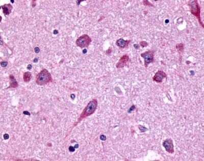 Immunohistochemistry-Paraffin: Frizzled-8 Antibody [NLS4776] - Analysis of anti-FZD8 / Frizzled 8 antibody with human brain, amygdala.