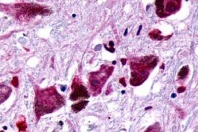 Immunohistochemistry-Paraffin: Frizzled-8 Antibody [NLS4776] - Anti-FZD8 / Frizzled 8 antibody IHC of human brain, substantia nigra. Immunohistochemistry of formalin-fixed, paraffin-embedded tissue after heat-induced antigen retrieval.