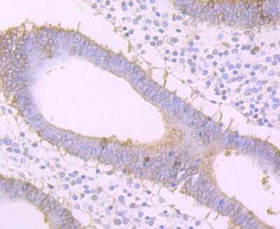 Immunohistochemistry-Paraffin: Frizzled-8 Antibody (JB40-16) [NBP2-75493] - Analysis of paraffin-embedded human uterus tissue using anti-Frizzled 8 antibody. Counter stained with hematoxylin.