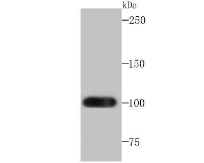 Western Blot: Frizzled-8 Antibody (JB40-16) [NBP2-75493] - Analysis of Frizzled 8 on mouse lung tissue lysates using anti-Frizzled 8 antibody at 1/500 dilution.