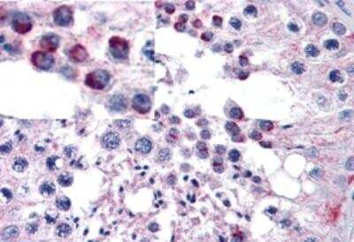 Immunohistochemistry-Paraffin: Frizzled-9 Antibody [NB100-94906] - Staining of paraffin embedded Human Testis. Antibody at 5 ug/mL. Steamed antigen retrieval with citrate buffer pH 6, AP-staining.