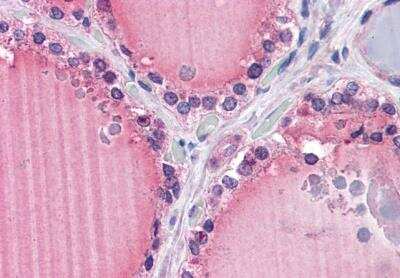 Immunohistochemistry-Paraffin: Frizzled-9 Antibody [NB100-94906] - Staining of paraffin embedded Human Thyroid. Antibody at 5 ug/mL. Steamed antigen retrieval with citrate buffer pH 6, AP-staining.