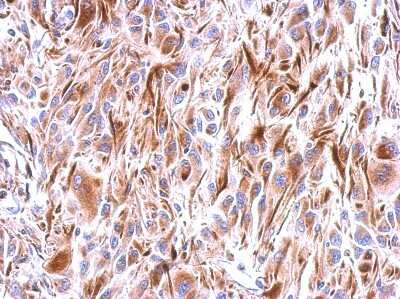 Immunohistochemistry-Paraffin: Frizzled-9 Antibody [NBP2-16533] - U374 xenograft, using Frizzled 9  antibody at 1:500 dilution.  Antigen Retrieval: Trilogy™ (EDTA based, pH 8.0) buffer, 15min