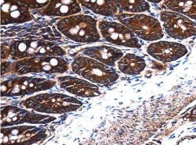 Immunohistochemistry-Paraffin: Frizzled-9 Antibody [NBP2-16533] -  Rat duodenum.  Frizzled 9 antibody [N1N2], N-term  diluted at 1:500. Antigen Retrieval: Trilogy™ (EDTA based, pH 8.0) buffer, 15min