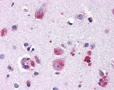 Immunohistochemistry-Paraffin: Frizzled-9 Antibody [NLS5097] - Analysis of anti-FZD9 / Frizzled 9 antibody with brains, neurons and glia at 14 ug/ ml.