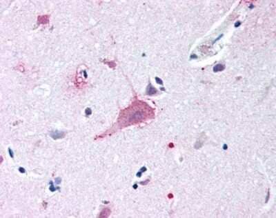 Immunohistochemistry-Paraffin: Frizzled-9 Antibody [NLS5118] - Analysis of anti-FZD9 / Frizzled 9 antibody with human brain, neurons and glia.