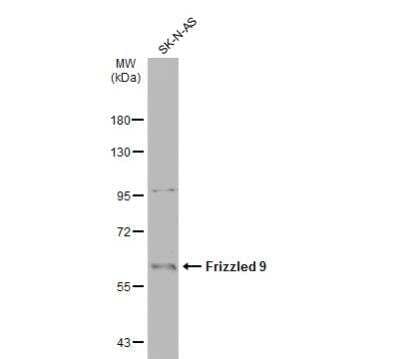 Western Blot: Frizzled-9 Antibody [NBP2-16533] - Whole cell extract (30 ug) was separated by 7.5% SDS-PAGE, and the membrane was blotted with Frizzled 9 antibody [N1N2], N-term diluted at 1:500. The HRP-conjugated anti-rabbit IgG antibody (NBP2-19301) was used to detect the primary antibody.