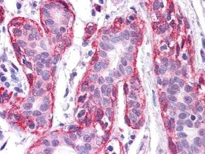 Immunohistochemistry-Paraffin: Frk Antibody (1A8H2C12) [NBP1-28857] - Immunohistochemical analysis of paraffin-embedded human Breast tissues using FRK mouse mAb.