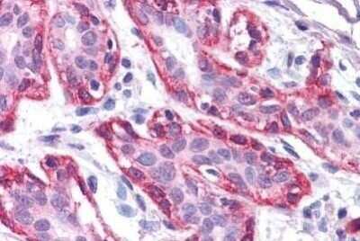 Immunohistochemistry-Paraffin: Frk Antibody (1A8H2C12) [NBP1-28857] - Staining of human breast. Immunohistochemistry of formalin-fixed, paraffin-embedded tissue after heat-induced antigen retrieval. Antibody dilution 1:200.