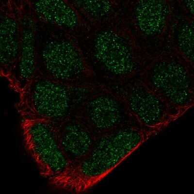 Immunocytochemistry/Immunofluorescence: Frk Antibody [NBP2-68617] - Staining of human cell line RT4 shows localization to nucleus.