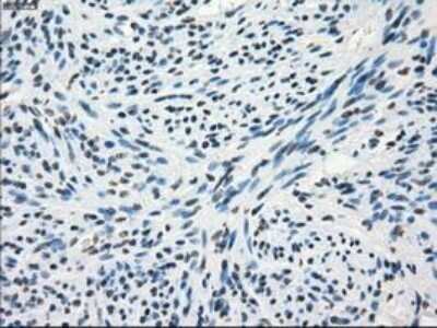 Immunohistochemistry: Frk Antibody (OTI6D2) - Azide and BSA Free [NBP2-70775] - Staining of paraffin-embedded Human pancreas tissue using anti-FRK mouse monoclonal antibody.