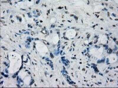 Immunohistochemistry-Paraffin: Frk Antibody (OTI6D2) [NBP1-47761] - Staining of paraffin-embedded Human colon tissue using anti-FRK mouse monoclonal antibody.