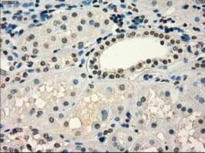 Immunohistochemistry-Paraffin: Frk Antibody (OTI6D2) [NBP1-47761] - Staining of paraffin-embedded Human endometrium tissue using anti-FRK mouse monoclonal antibody.