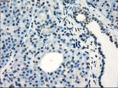 Immunohistochemistry-Paraffin: Frk Antibody (OTI6D2) [NBP1-47761] - Staining of paraffin-embedded Human Ovary tissue using anti-FRK mouse monoclonal antibody.