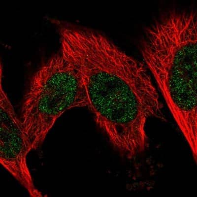 Immunocytochemistry/Immunofluorescence: Fructosamine-3-kinase-related Antibody [NBP2-55370] - Staining of human cell line U-251 MG shows localization to nucleoplasm.