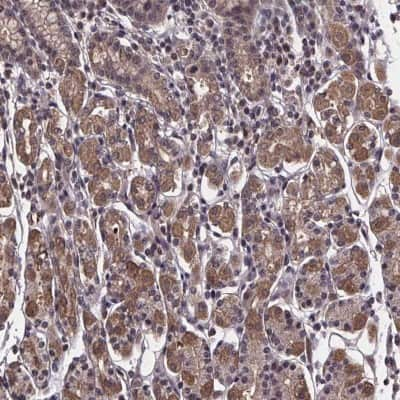 Immunohistochemistry: Fructosamine-3-kinase-related Antibody [NBP2-39063] - Staining of human stomach shows moderate cytoplasmic positivity in glandular cells.