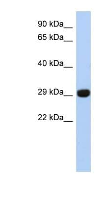 Western Blot: Fructosamine-3-kinase-related Antibody [NBP1-56367] - Jurkat cell lysate, concentration 0.2-1 ug/ml.