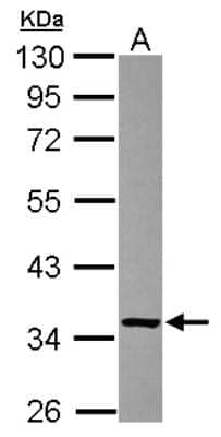 Western Blot: Fructosamine-3-kinase-related Antibody [NBP2-16536] - Sample (30 ug of whole cell lysate) A: U87-MG 10% SDS PAGE gel, diluted at 1:1000.