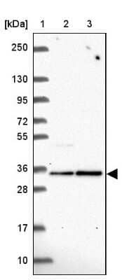 Western Blot: Fructosamine-3-kinase-related Antibody [NBP2-39063] - Lane 1: Marker  [kDa] 250, 130, 95, 72, 55, 36, 28, 17, 10.  Lane 2: Human cell line RT-4.  Lane 3: Human cell line U-251MG