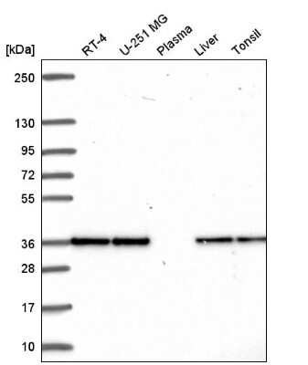 Western Blot: Fructosamine-3-kinase-related Antibody [NBP2-55370] - Western blot analysis in human cell line RT-4, human cell line U-251 MG, human plasma, human liver tissue and human tonsil tissue.