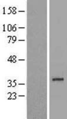 Western Blot: Fructosamine-3-kinase-related Overexpression Lysate (Adult Normal) [NBL1-10781] Left-Empty vector transfected control cell lysate (HEK293 cell lysate); Right -Over-expression Lysate for Fructosamine-3-kinase-related.