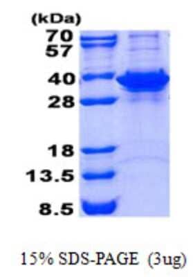 SDS-Page: Fructosamine-3-kinase-related Protein [NBP2-23060]