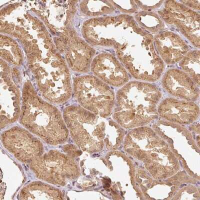 Immunohistochemistry-Paraffin: Fucosyltransferase 8/FUT8 Antibody [NBP2-30689] - Staining of human kidney shows moderate granular cytoplasmic positivity in cells in tubules.