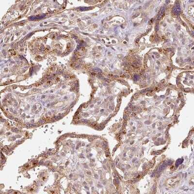 Immunohistochemistry-Paraffin: Fucosyltransferase 8/FUT8 Antibody [NBP2-30689] - Staining of human placenta shows moderate granular cytoplasmic positivity in trophoblastic cells.