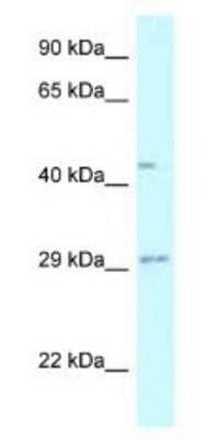 Western Blot: Fucosyltransferase 8/FUT8 Antibody [NBP1-79869] - Fetal Liver Lysate 1ug/ml  Gel Concentration 12%