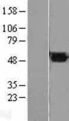 Western Blot Fumarase Overexpression Lysate