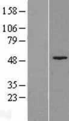 Western Blot: Fumarylacetoacetate hydrolase Overexpression Lysate (Adult Normal) [NBL1-10428] Left-Empty vector transfected control cell lysate (HEK293 cell lysate); Right -Over-expression Lysate for Fumarylacetoacetate hydrolase.