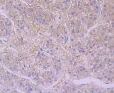 Immunohistochemistry-Paraffin: Furin Antibody (JB35-53) [NBP2-75495] - Analysis of paraffin-embedded human liver tissue using anti-Furin antibody. Counter stained with hematoxylin.