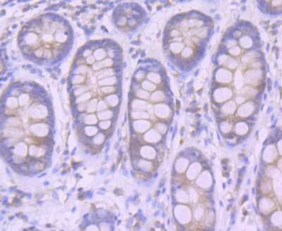 Immunohistochemistry-Paraffin: Furin Antibody (JB35-53) [NBP2-75495] - Analysis of paraffin-embedded human colon tissue using anti-Furin antibody. Counter stained with hematoxylin.