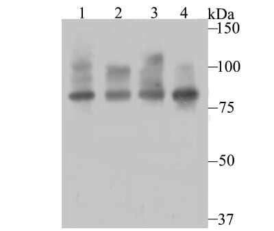 Western Blot: Furin Antibody (JB35-53) [NBP2-75495] - Analysis of Furin on different cell lysates using anti-Furin antibody at 1/500 dilution.Positive control:Lane 1: HepG2      Lane 2: HelaLane 3: Hela       Lane 4: MCF-7