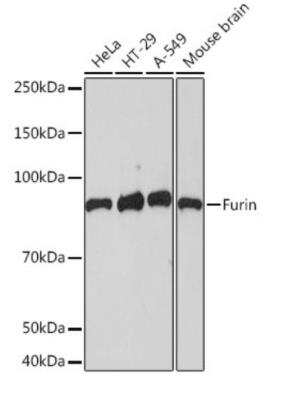 Western Blot: Furin Antibody [NBP3-07955] - Western blot analysis of extracts of various cell lines, using Rabbit Monoclonal Furin Antibody at 1:1000 dilution. Secondary antibody: HRP Goat Anti-Rabbit IgG (H+L) at 1:10000 dilution. Lysates/proteins: 25ug per lane. Blockin buffer: 3% nonfat dry milk TBST. Exposure time: 90s.