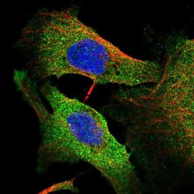 Immunocytochemistry/Immunofluorescence: Fyn Antibody [NBP2-57212] - Staining of human cell line U-2 OS shows localization to plasma membrane & cytosol. Antibody staining is shown in green. 