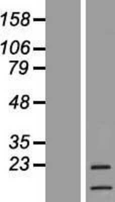 Western Blot: G-CSF Overexpression Lysate (Adult Normal) [NBL1-09518] Left-Empty vector transfected control cell lysate (HEK293 cell lysate); Right -Over-expression Lysate for G-CSF.