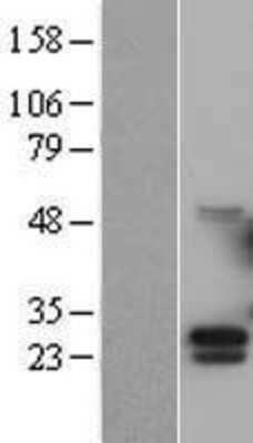 Western Blot: G-CSF Overexpression Lysate (Adult Normal) [NBL1-09519] Left-Empty vector transfected control cell lysate (HEK293 cell lysate); Right -Over-expression Lysate for G-CSF.