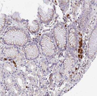 Immunohistochemistry-Paraffin: G-CSF R/CD114 Antibody [NBP2-33513] - Staining of human stomach shows moderate to strong cytoplasmic positivity in leukocytes.