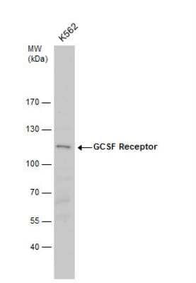 Western Blot: G-CSF R/CD114 Antibody [NBP2-16629] -  Whole cell extracts (30 ug) was separated by 7.5% SDS-PAGE, and the membrane was blotted with GCSF Receptor antibody diluted by 1:500.