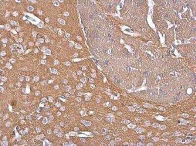 Immunohistochemistry-Paraffin: G Protein alpha z Antibody [NBP1-31604] - Mouse brain. G Protein alpha z stained by G Protein alpha z antibody [N2C3] diluted at 1:500.