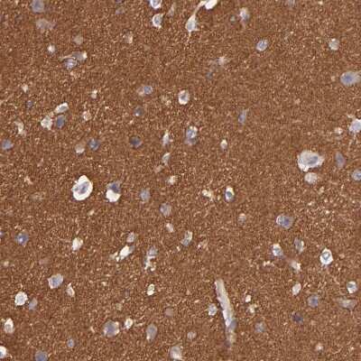 Immunohistochemistry-Paraffin: G Protein alpha z Antibody [NBP1-88111] - Staining of human cerebral cortex shows strong cytoplasmic positivity in neuropil.